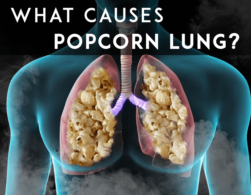What is popcorn lung? Can you get it from vaping?